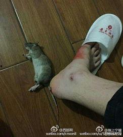 老鼠咬人视频,揭秘老鼠咬人事件背后的真相